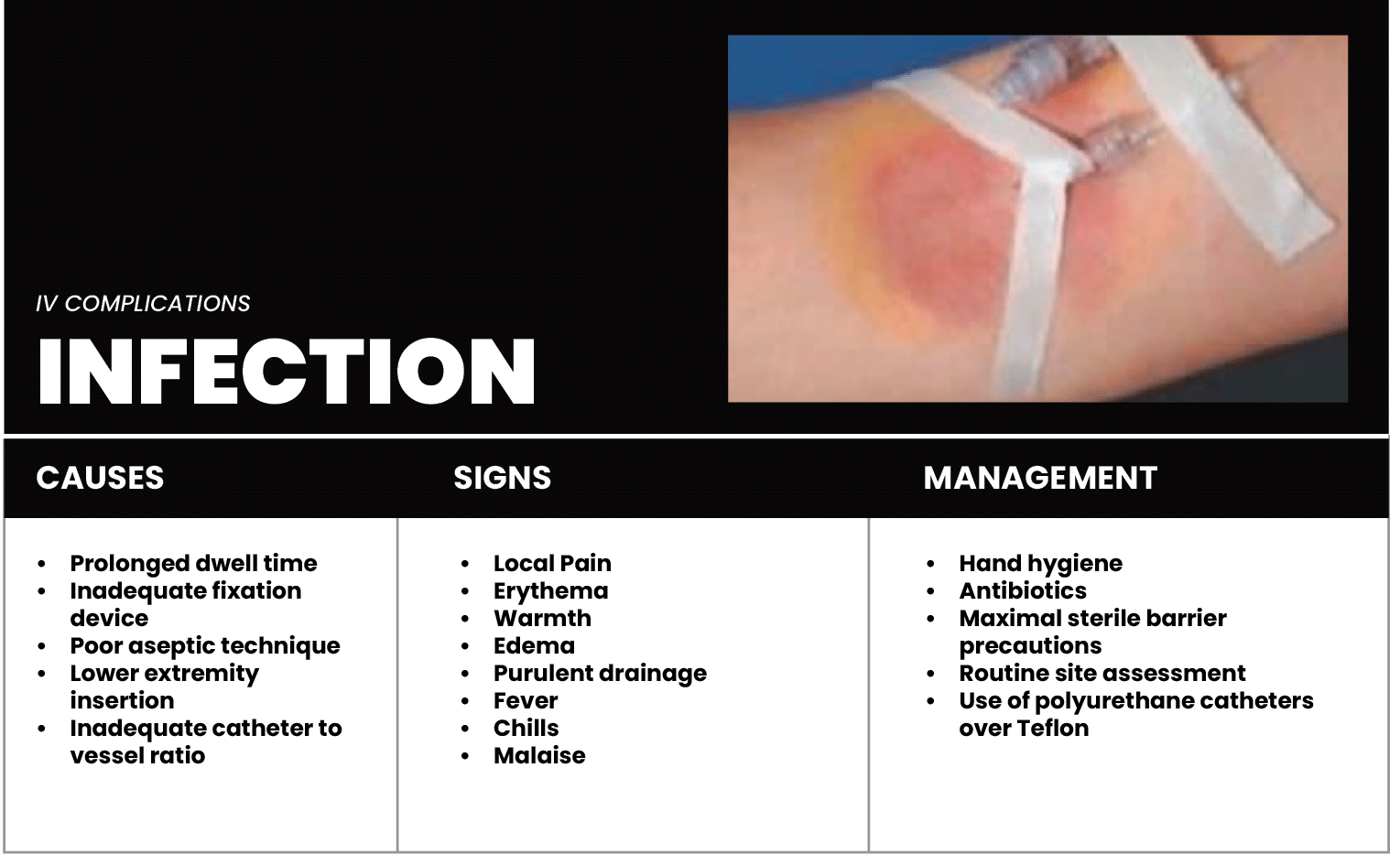 Infective Phlebitis Treatment